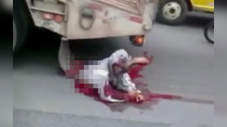 【閲覧注意】トラックに轢かれて胴体切断されたけど結構生きてる男のグロ動画。