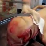 【閲覧注意】頭蓋骨を開き脳を摘出するグロ動画。