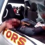 【閲覧注意】自動車事故で頭から脳がこぼれ落ちて死んだグロ動画。