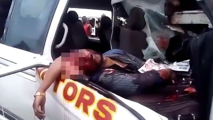 【閲覧注意】自動車事故で頭から脳がこぼれ落ちて死んだグロ動画。