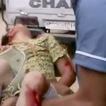 【閲覧注意】砲撃を受けて頭が破裂してしまった女の子のグロ動画。