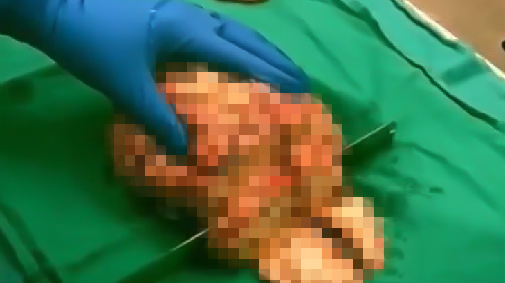 【閲覧注意】摘出した人間の脳を輪切りにするグロ動画。