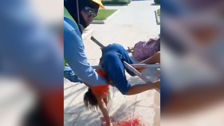 【閲覧注意】バイク事故で鉄柵が身体に突き刺さってしまった女の子の映像。