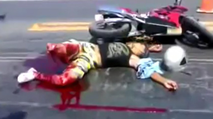 【閲覧注意】バイク事故で右脚切断されてしまった男性が苦しむ映像。