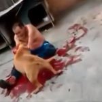 ペットのピットブルに噛みつかれて血だらけになってしまった男の映像。