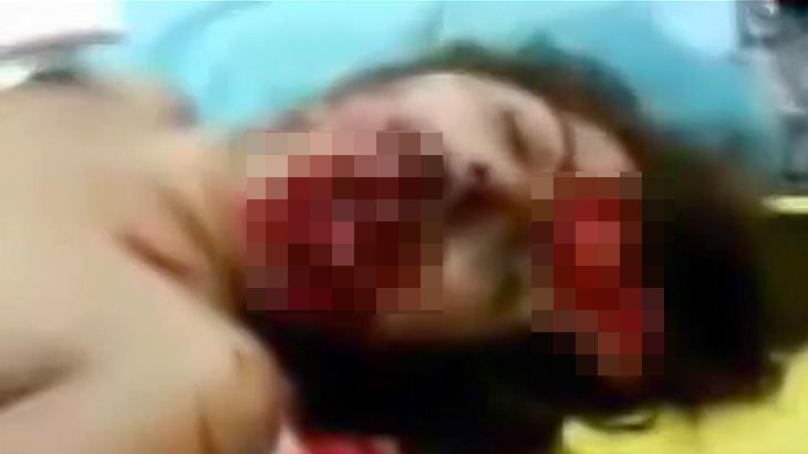 【閲覧注意】拳銃自殺に失敗して口がグチャグチャになってしまった女性の映像。