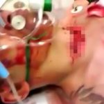 【閲覧注意】腹から内臓が飛び出している男を治療する映像。