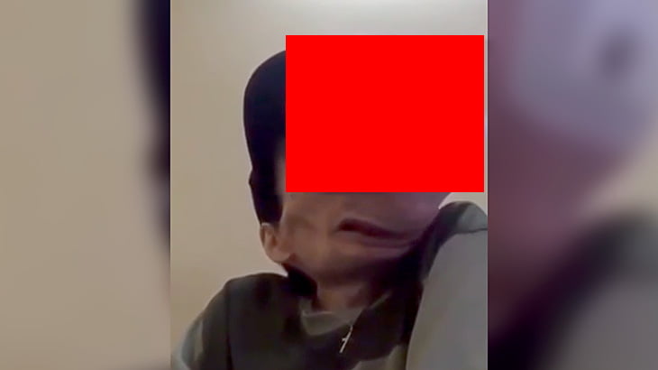 顔と同じくらい大きな腫瘍がくっついている男の映像