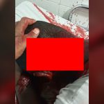 【閲覧注意】マチェーテでパックリ切られた後頭部から血が吹き出る映像