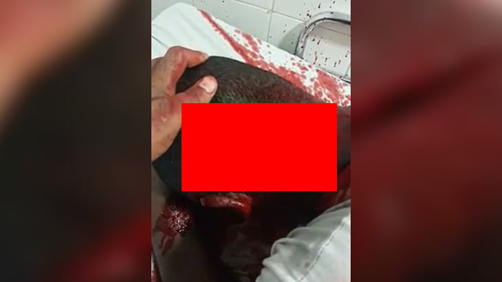 【閲覧注意】マチェーテでパックリ切られた後頭部から血が吹き出る映像