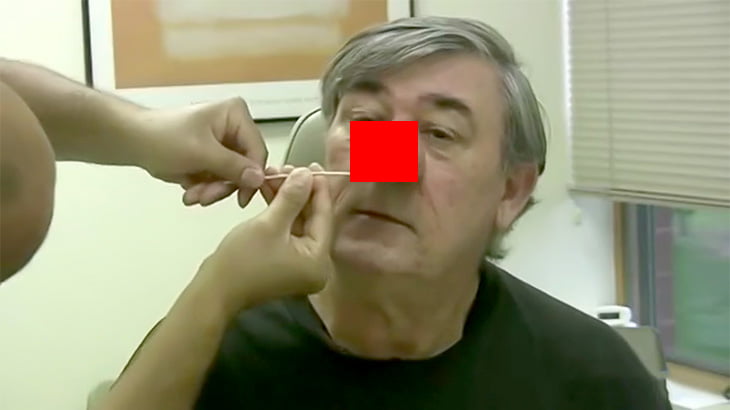 【閲覧注意】まるで手塚治虫マンガに出てくるキャラクターの鼻みたいになってしまった男の手術映像