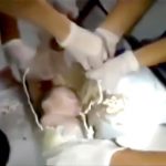 【動画】公衆トイレに流された産まれたばかりの赤ちゃん、生きたまま排水管から救出される
