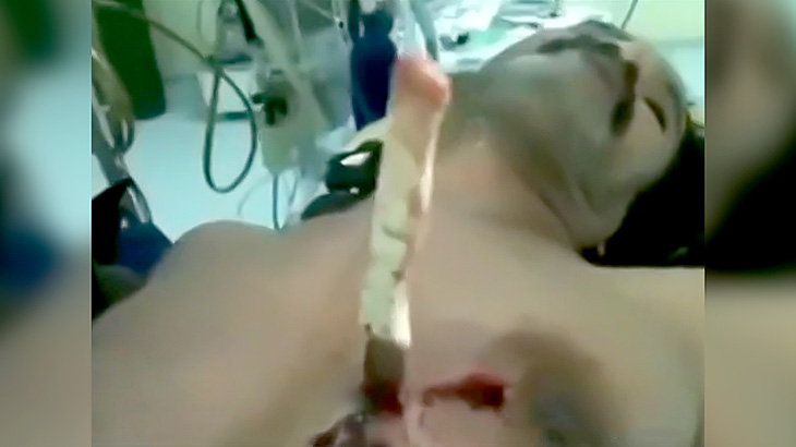 心臓近くに突き刺されたナイフが鼓動に合わせてビクンビクン動く映像