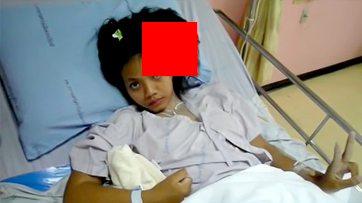 【動画】頭に “もう一つの頭” を持つ女の子の映像