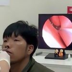 【動画】鼻の穴から “わりと大きめのヒル” を摘出する映像