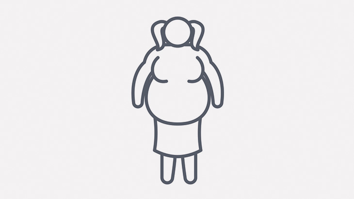 この肥満女性の膝、折れちゃいそう