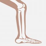 【閲覧注意】膝下を切断する手術?像