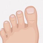 【閲覧注意】足の指を医療用ハサミで切断する手術映像