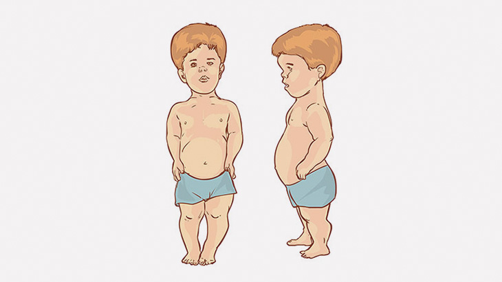 小人症の2人の男性によるボクシングを笑いながら撮影する健常者たち（動画）