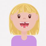 歯が無い女性がインプラントした結果 → 10歳くらい若返る（動画）