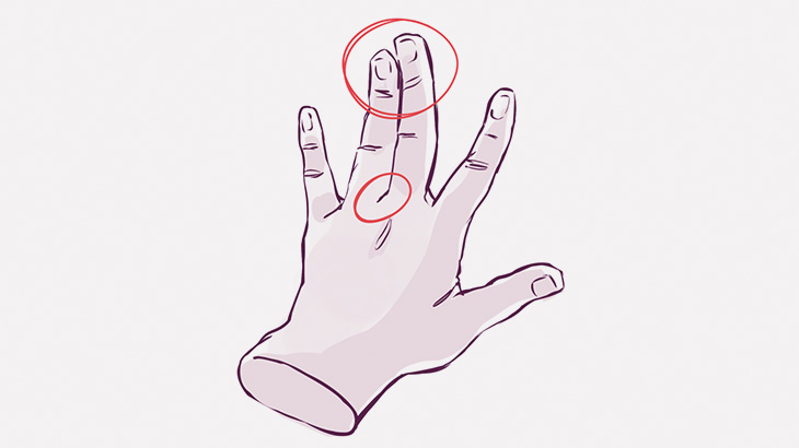 中指と薬指がくっついてしまった男が撮影される（動画）