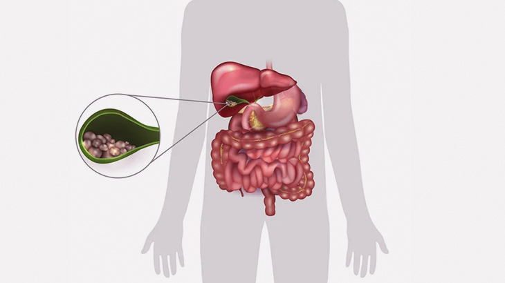 【閲覧注意】医者「胆嚢の摘出手術を紹介しますね！」（動画）