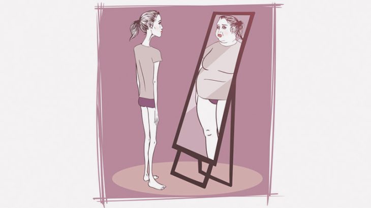 拒食症の女性の体、ヤバすぎ･･･（画像）