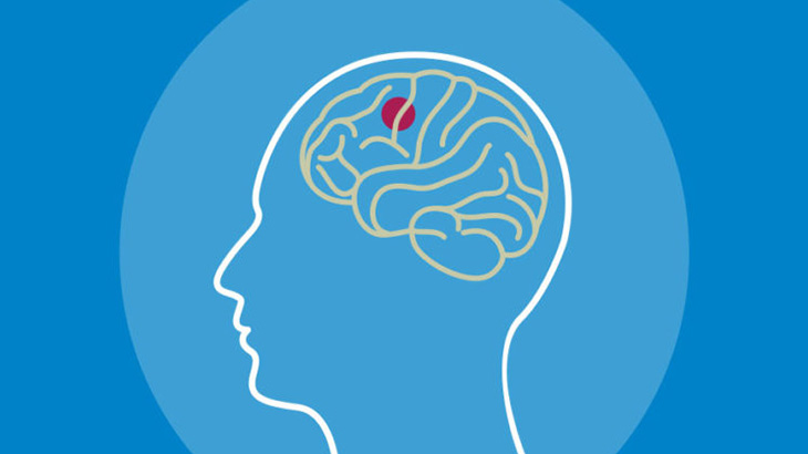 【閲覧注意】医者「脳腫瘍を摘出しますね」（動画）