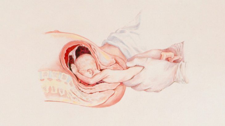 【閲覧注意】出産の様子かな？ → と思いきや･･･（画像）