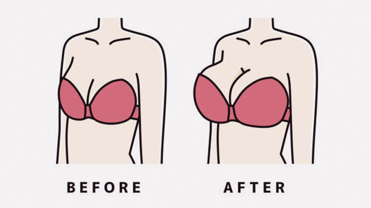 【微閲覧注意】マンさん「オッパイ割れちゃったｗｗｗｗ」（動画）