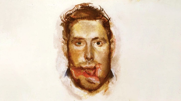 【閲覧注意】銃撃された兵士、顔が割れてしまう･･･（動画）