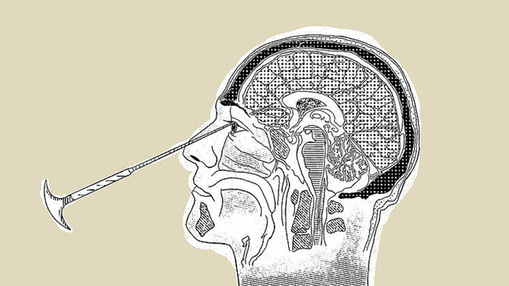 【微閲覧注意】かつて行われていた恐ろしい手術「ロボトミー」（動画）