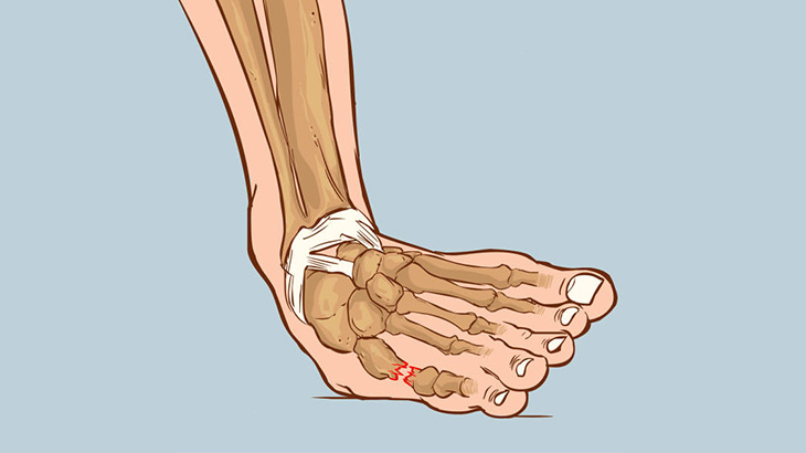 この男の足首、おかしいなことになってる･･･（動画）