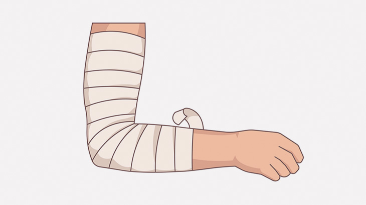 火事から生還した女性の体、水疱だらけ･･･（動画）