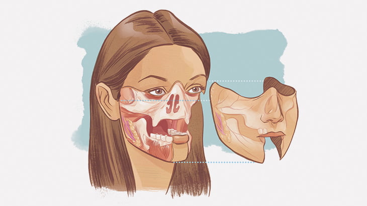 【閲覧注意】銃弾で顔が割れた女性の顔面移植ビフォーアフター（画像）