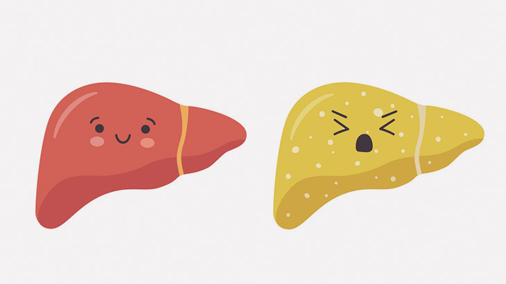 肌の色が違いすぎる、肝移植ビフォーアフター（画像）