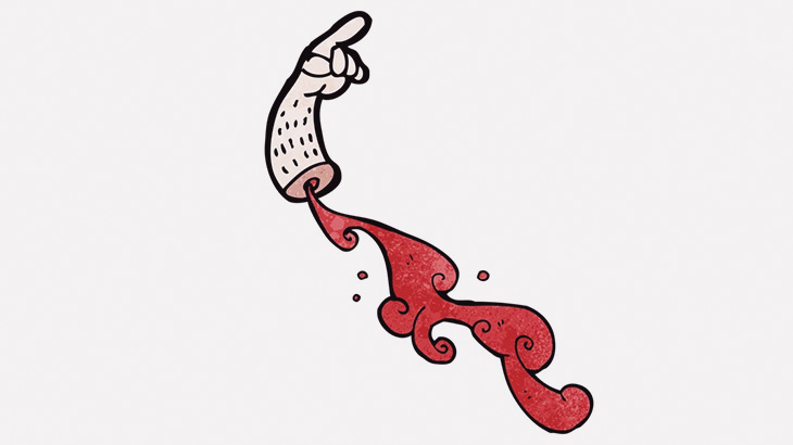 【閲覧注意】男「手首切断されちゃったｗｗｗｗ」（動画）