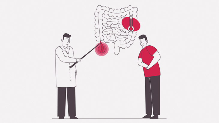 【閲覧注意】この肉塊、13kgのウンコが詰まった腸だそうです･･･（画像）
