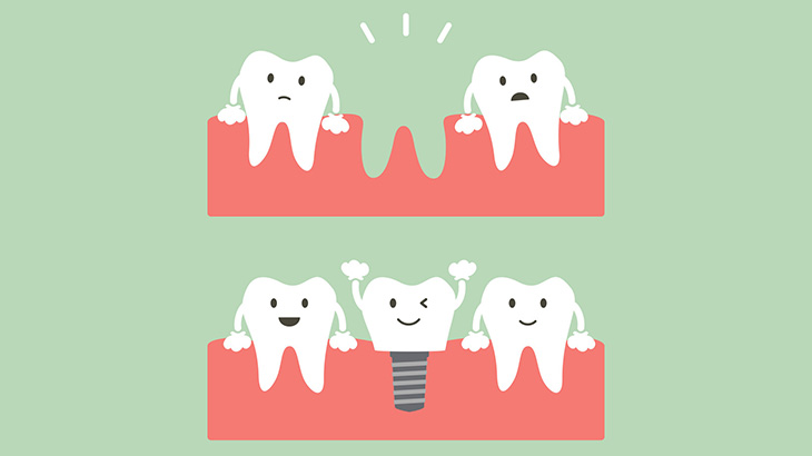 【閲覧注意】男「歯を全部抜いて綺麗にしてもらったｗｗｗｗ」（画像）