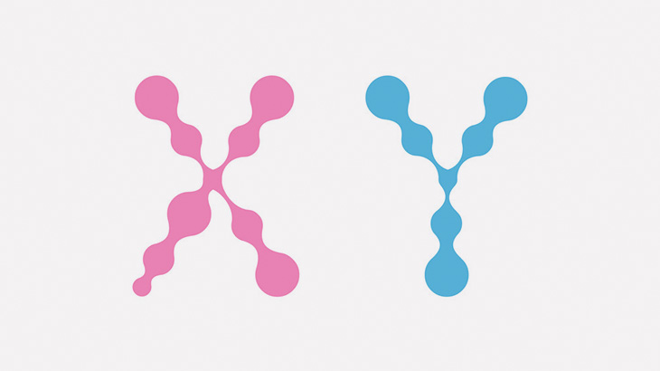 【閲覧注意】パトウ症候群（13トリソミー）の赤ちゃんたち（画像）