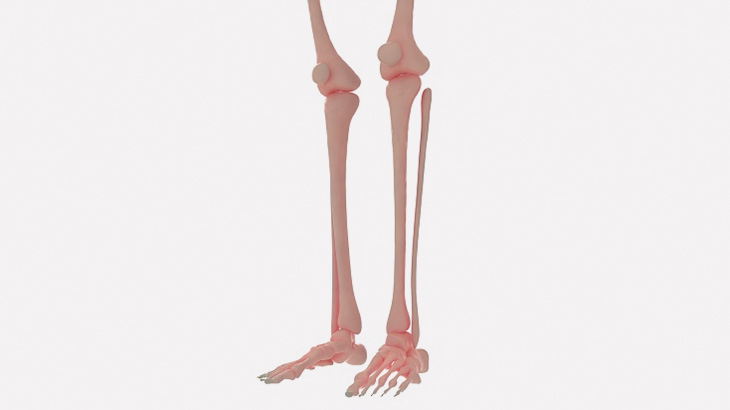 この男の関節、どうなってるの？（動画）