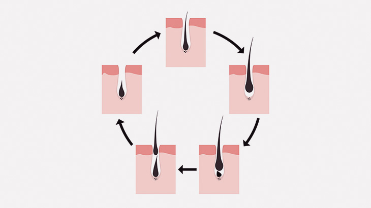 【微閲覧注意】植毛のために毛根を大量に引っこ抜く手術映像