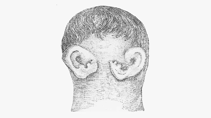 【閲覧注意】コレ、人間の赤ちゃんって信じられる･･･？（画像）