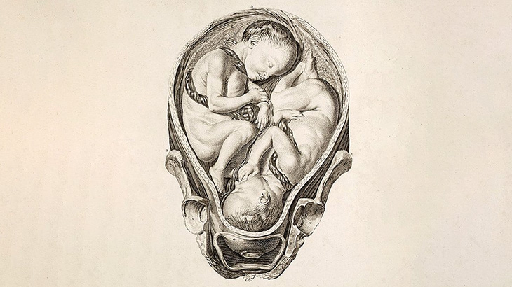 【閲覧注意】少年「お腹が痛いんです･･･」 → とんでもないものが入ってた･･･（画像）