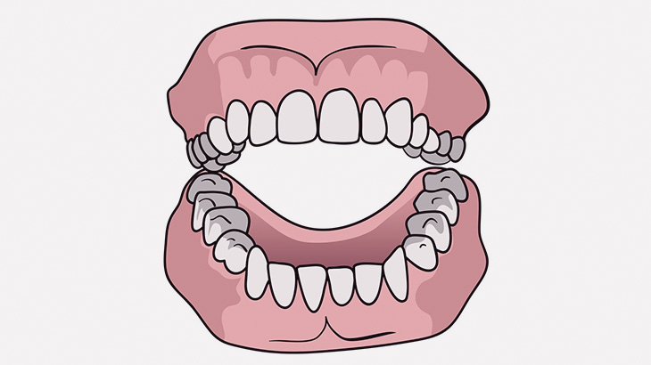 【閲覧注意】腐敗が少し進んだ人間の歯茎（動画）