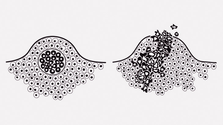 うちのおじいちゃん、身体中コブだらけだからちょっと見て（動画）