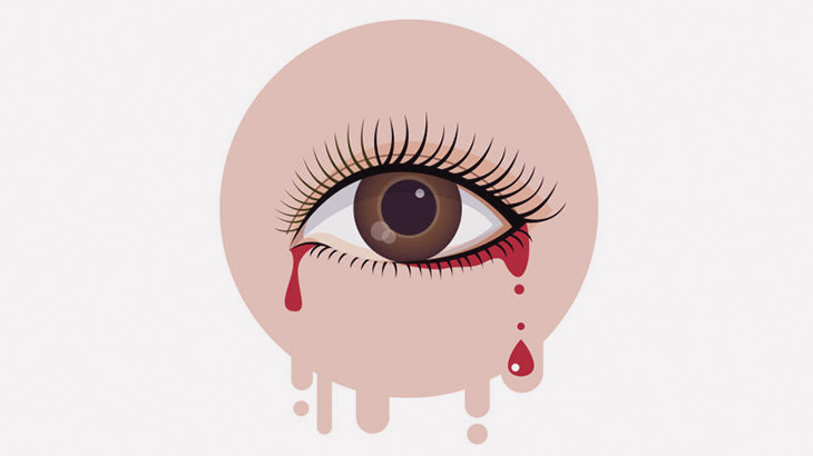 【閲覧注意】女性の左目に突き刺さってしまったナイフを引っこ抜く手術（動画）