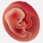 妊娠６週目の女性が中絶薬を飲む → こんなものが身体から出てくる･･･（画像）