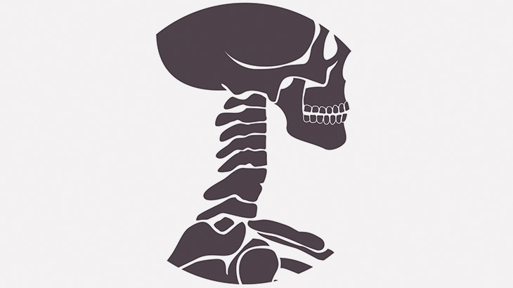 この少年の首、長すぎる･･･（画像）