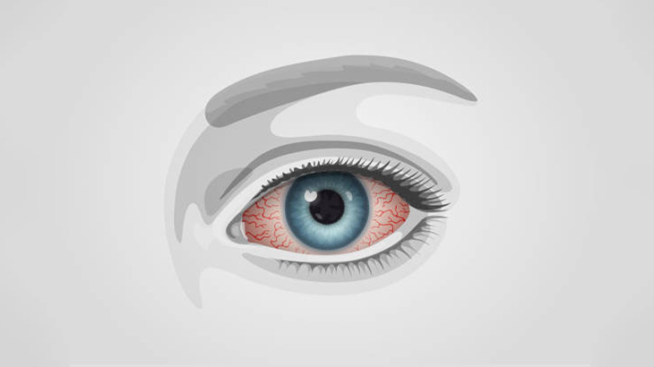 【微閲覧注意】女「左目ヤバいことになっちゃった･･･」（動画）